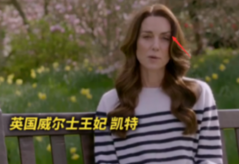 凱特王妃露面稱患癌